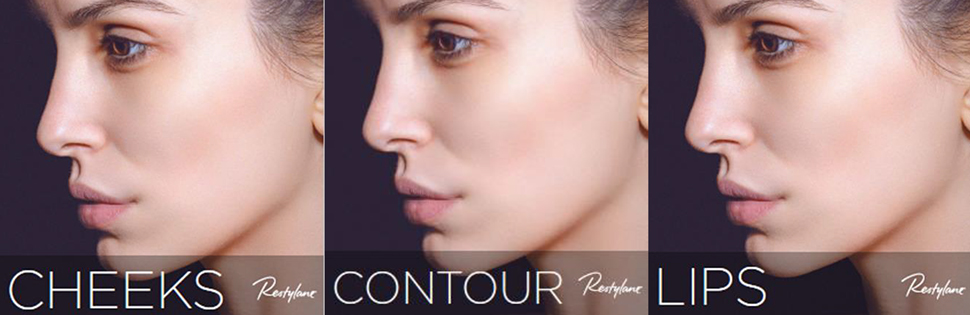 lips restylane